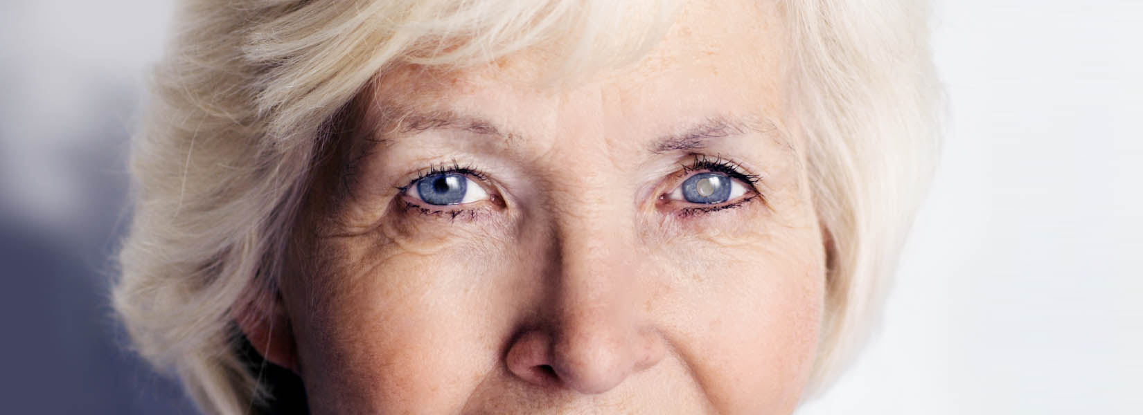 Cataract Surgery in Winter Park